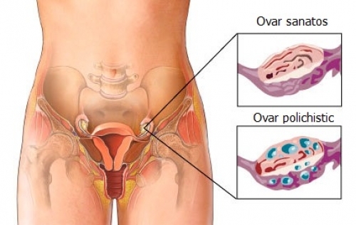 Endocrinologie De Ce Sa Iti Faci Controlul Anual Donna Medical