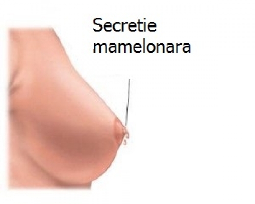 Secrețiile mamelonare sau Galactoreea