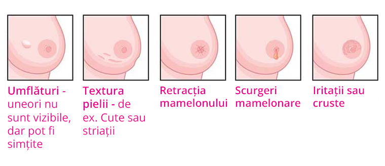 cancer mamar inflamator simptome)