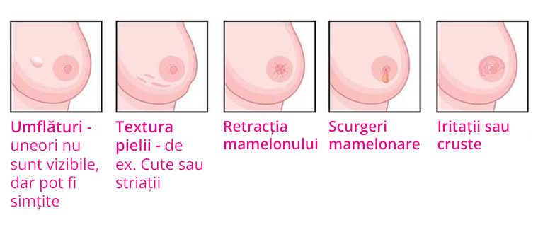 Cele mai comune simptome in cancerul de san