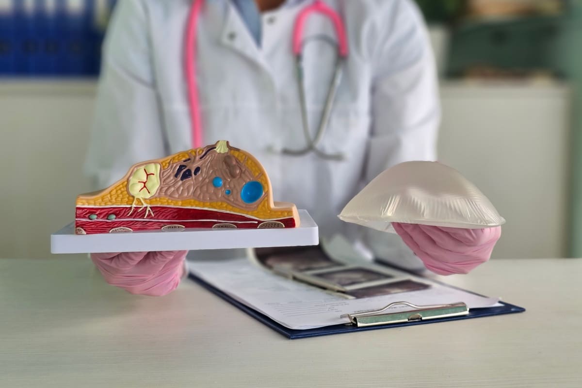 medic explica reconstructia sanului 