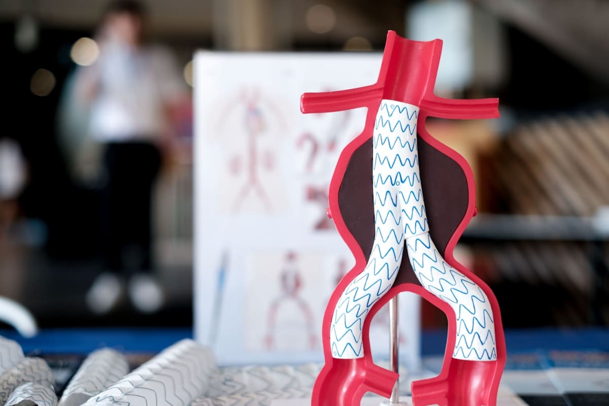model anatomic anevrism aorta